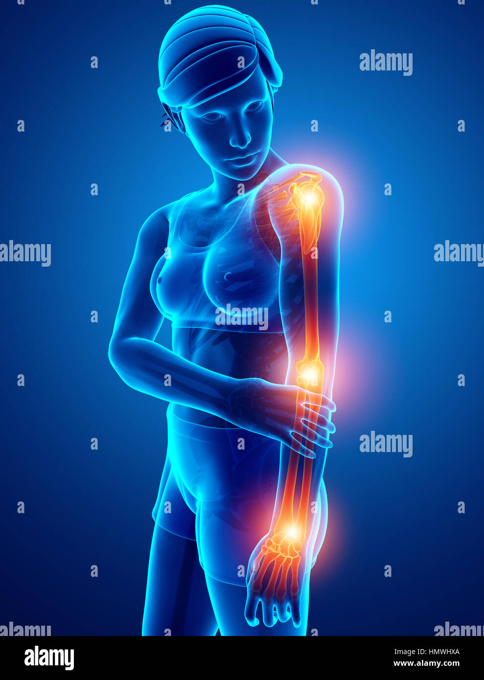 3d Illustration of Women Feeling Arm joint pain Stock Photo Alamy