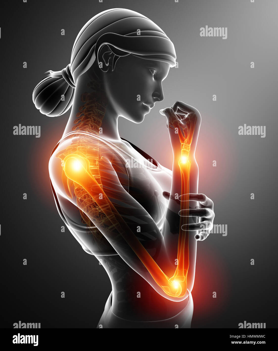 3d Illustration of Women Feeling Arm joint pain Stock Photo Alamy