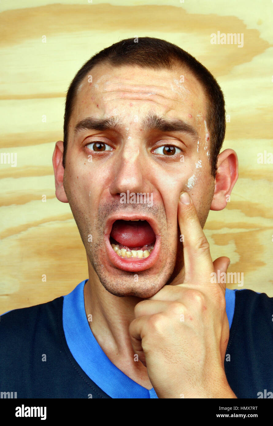 Young man with a chronic infection of the skin on the face Stock Photo ...