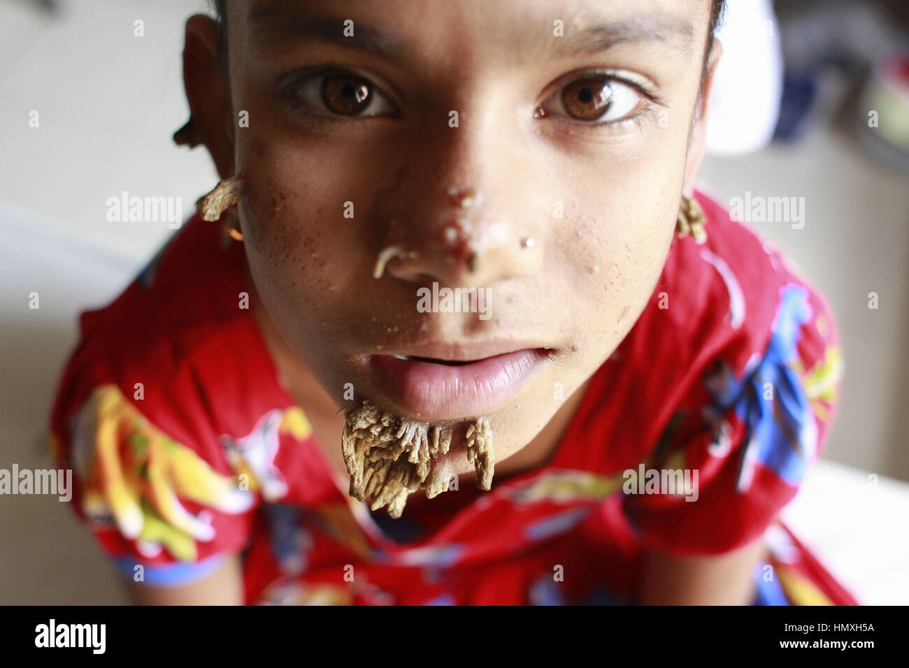 Dhaka, Bangladesh. 6th Feb, 2017. Bangladeshi girl Sahana Khatun, 10