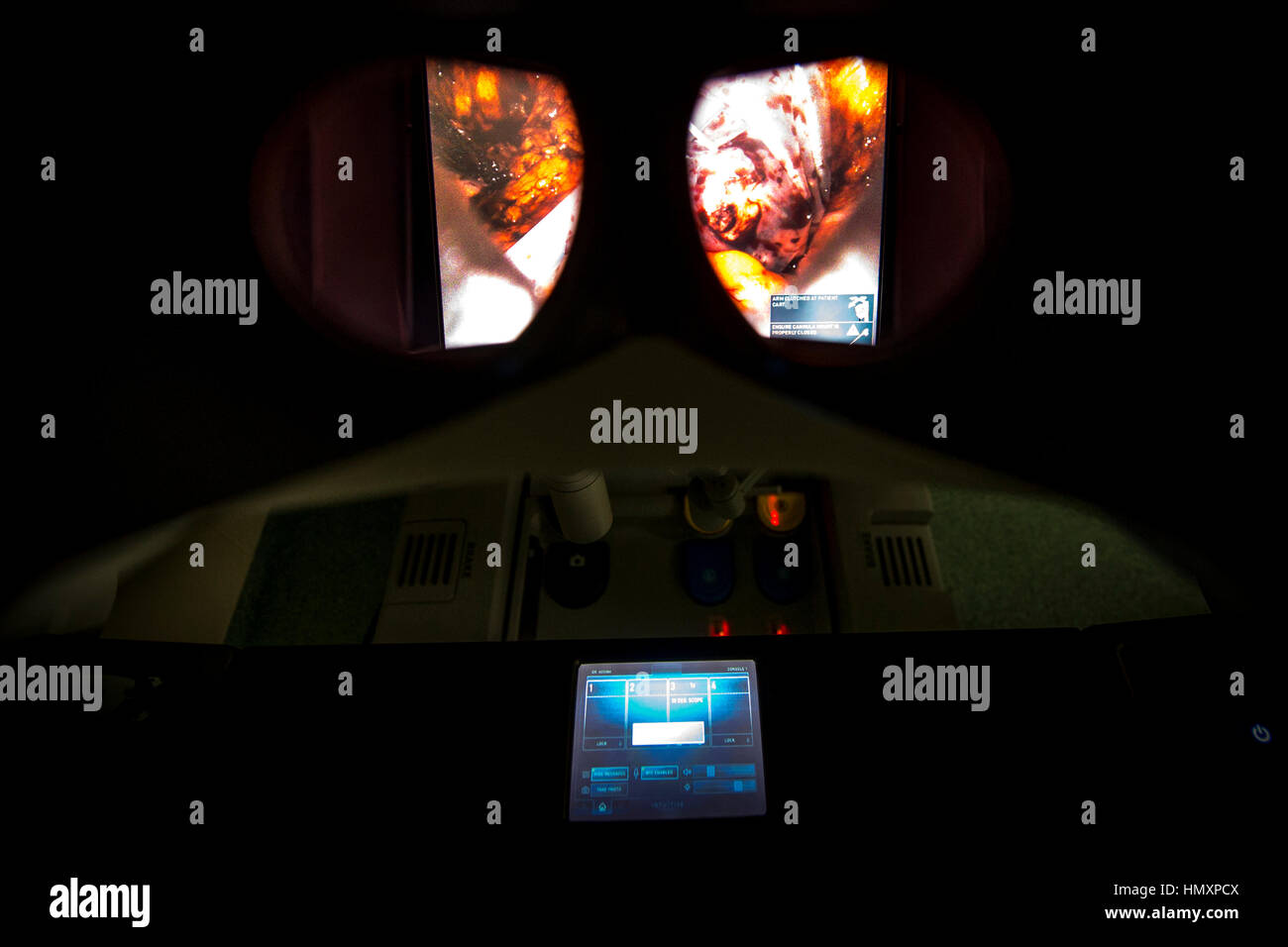 Hradec Kralove, Czech Republic. 07th Feb, 2017. The da Vinci Surgical