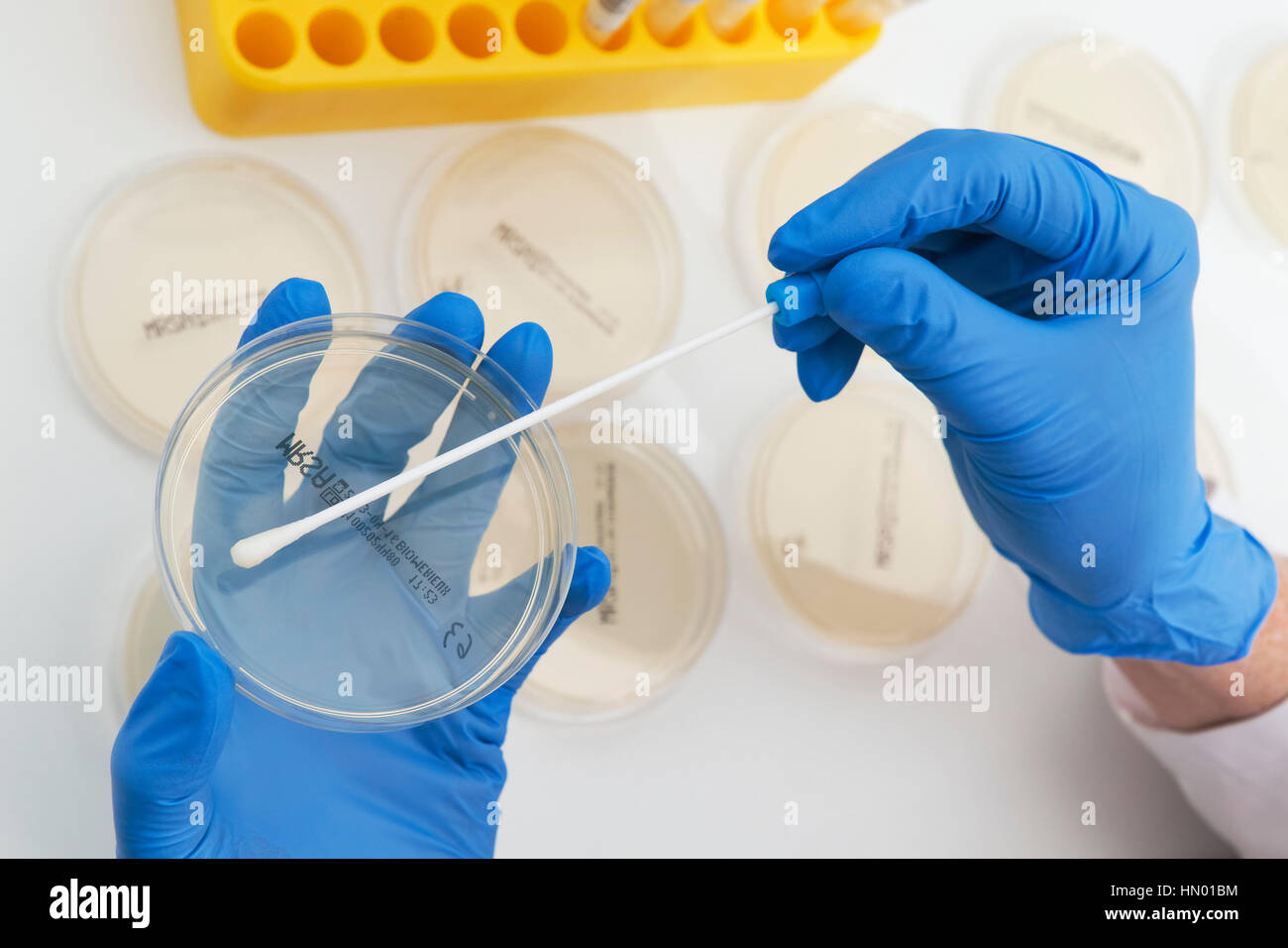 Swab From Mucous Membranes Is Cultivated In Petri Dishes Stock Photo Alamy