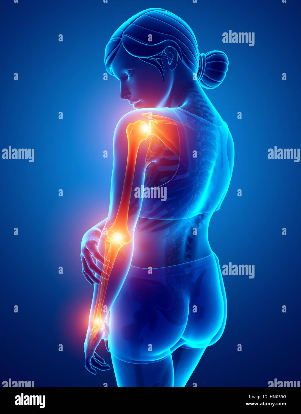 3d Illustration of Women Feeling Arm joint pain Stock Photo Alamy