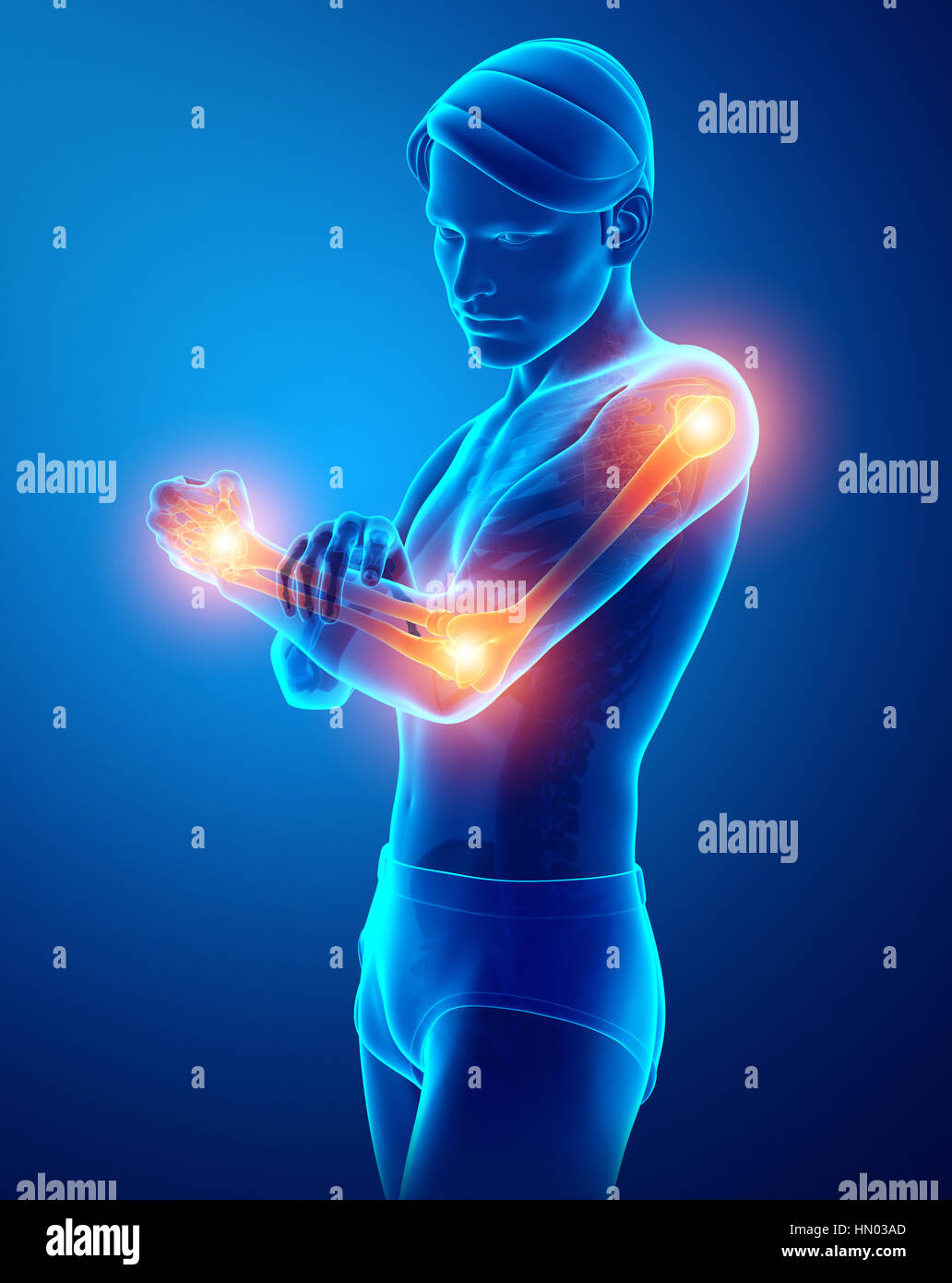 3d Illustration of Men Feeling Arm joint pain Stock Photo Alamy