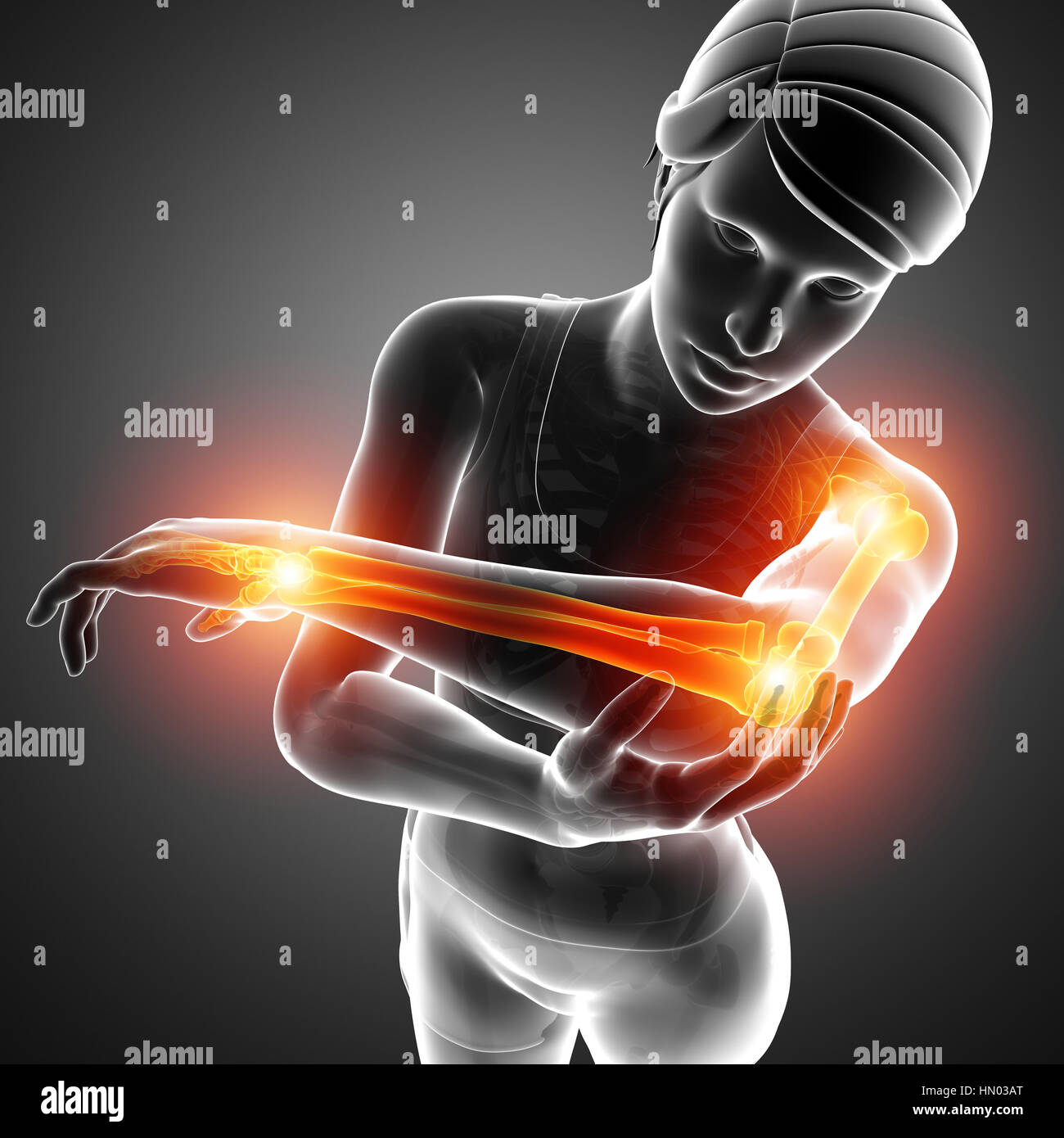3d Illustration of Men Feeling Arm joint pain Stock Photo Alamy