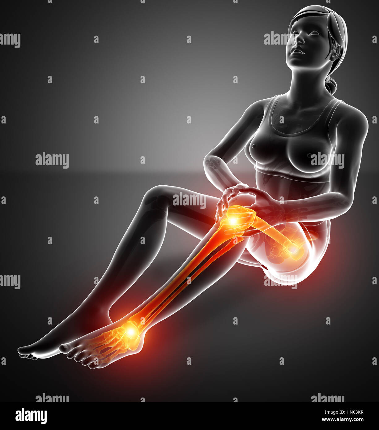 3d Illustration of Women Leg joint pain Stock Photo Alamy