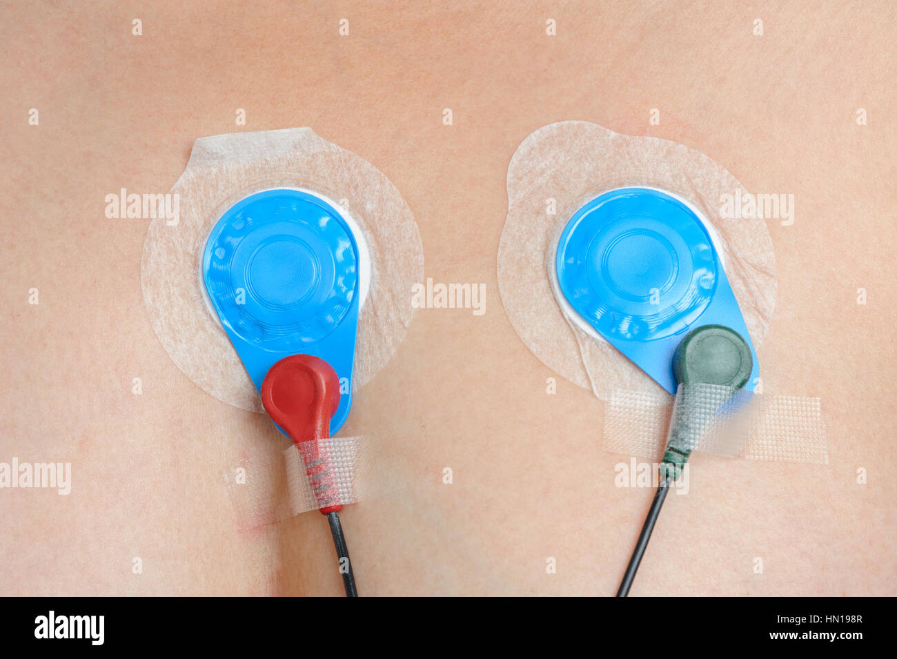 Young woman wearing a Holter Heart Monitor Stock Photo Alamy