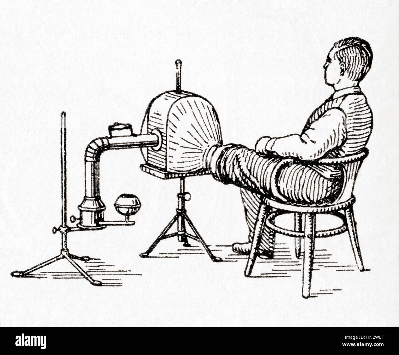 A 19th century hot air apparatus used for heating limbs. From Meyers Lexicon, published 1927