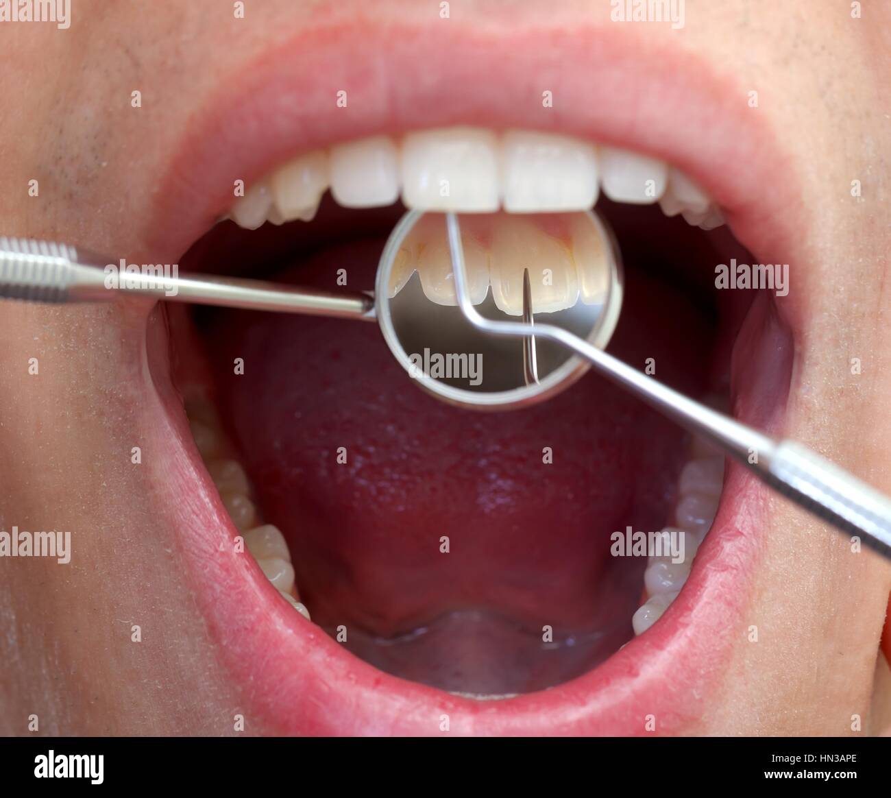 Close up of an extensive dental examination Stock Photo Alamy