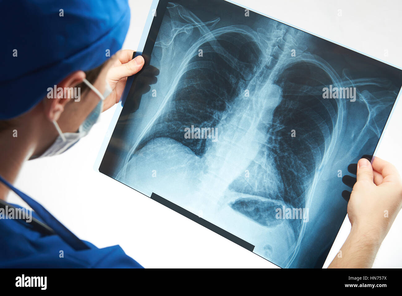 x-ray image of human chest in doctor hands isolated on white Stock Photo