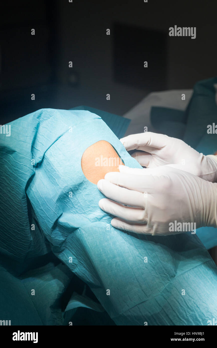 Preparing knee for surgery hospital operation medical procedure in emergency room operating theater. Stock Photo