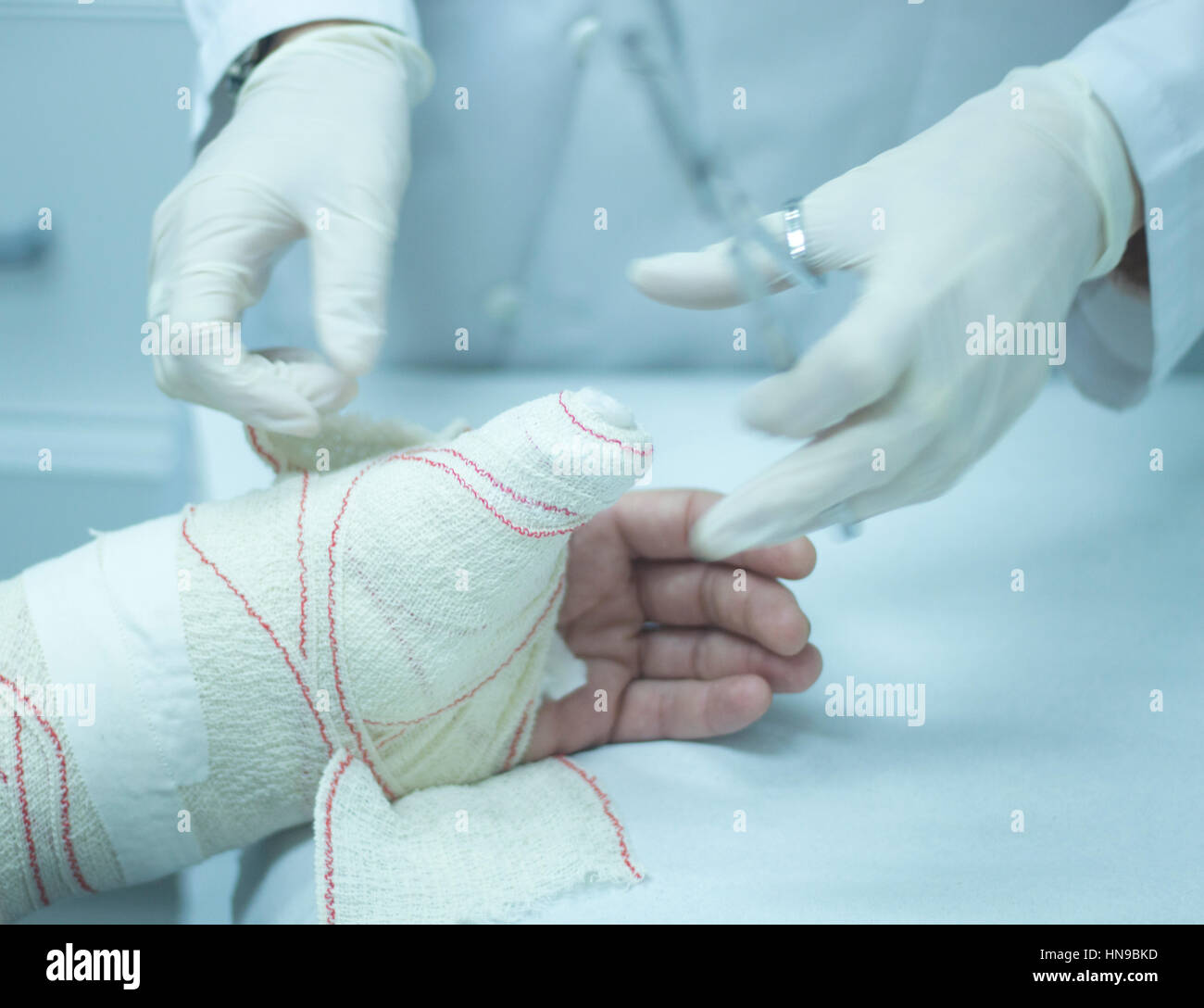 Doctor applying a plaster cast and bandages to patient forearm and