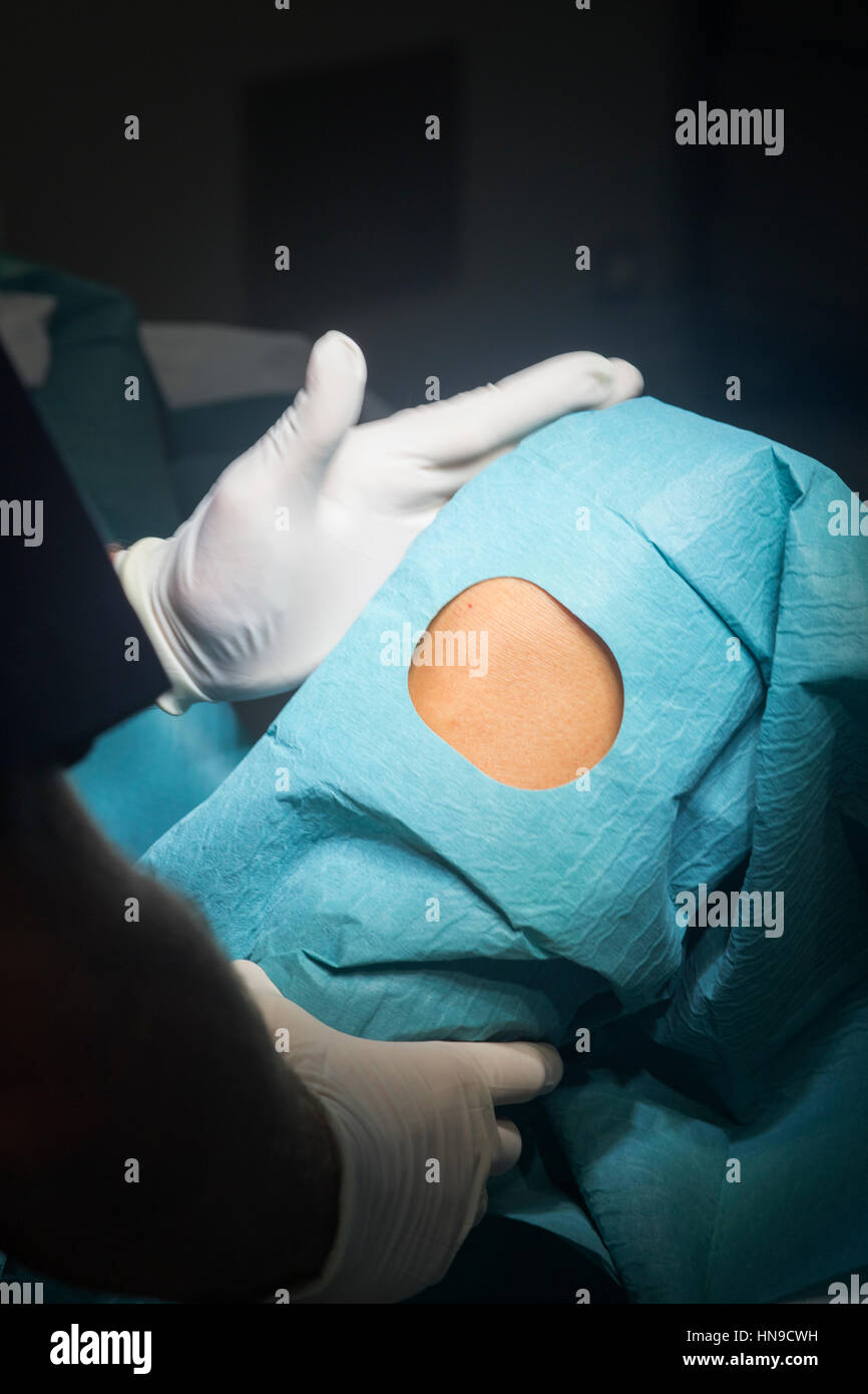 Preparing knee for surgery hospital operation medical procedure in emergency room operating theater. Stock Photo