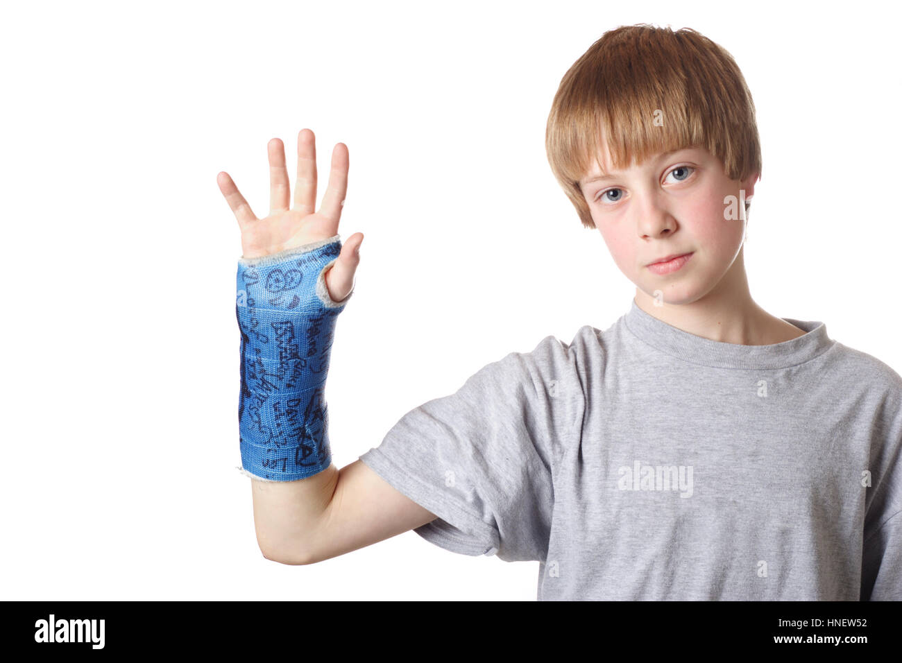 Child signed arm cast hires stock photography and images Alamy