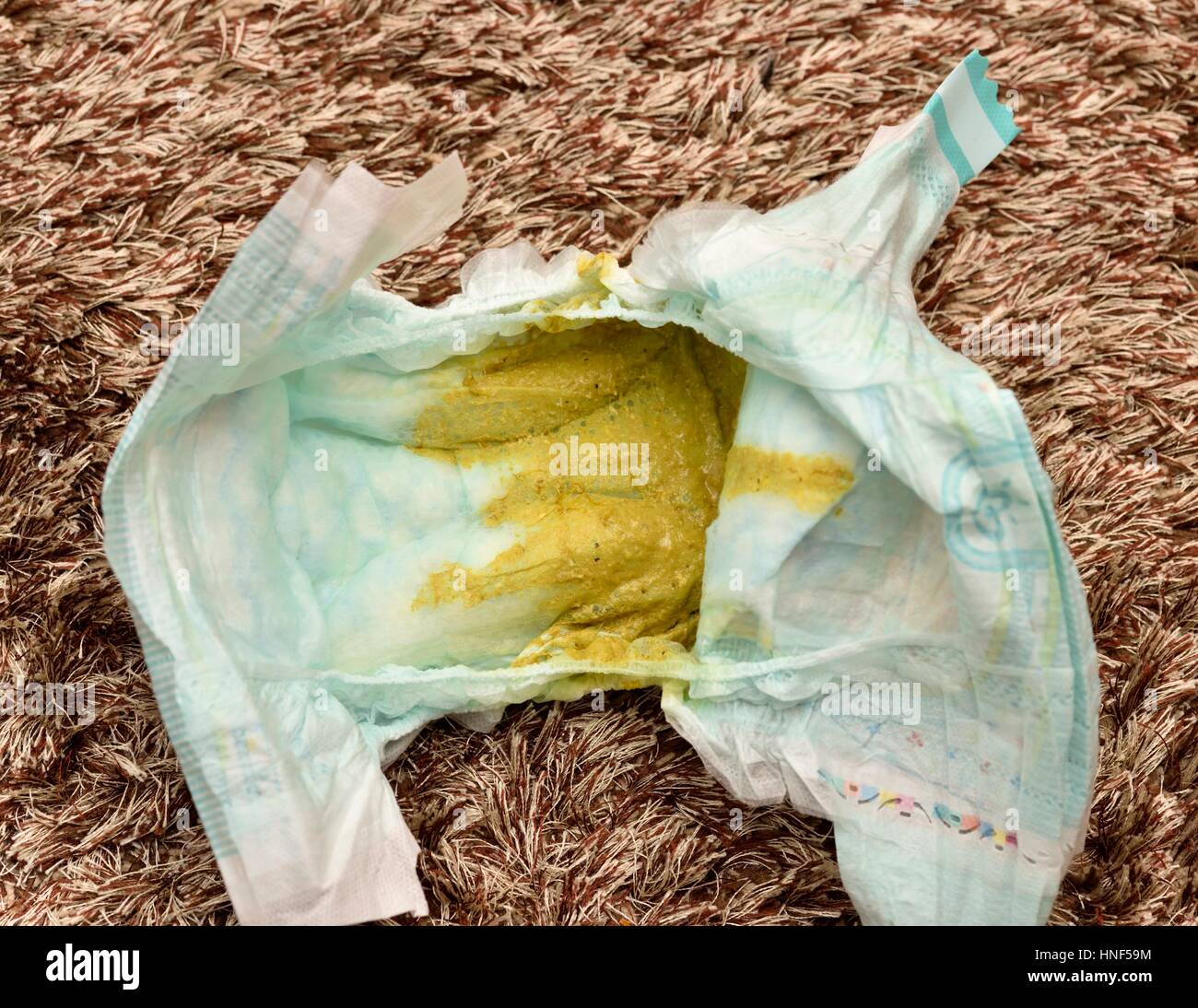 Nappies Leaking Poo At Christopher Schauer Blog Nappies Leaking Poo At Christopher Schauer Blog