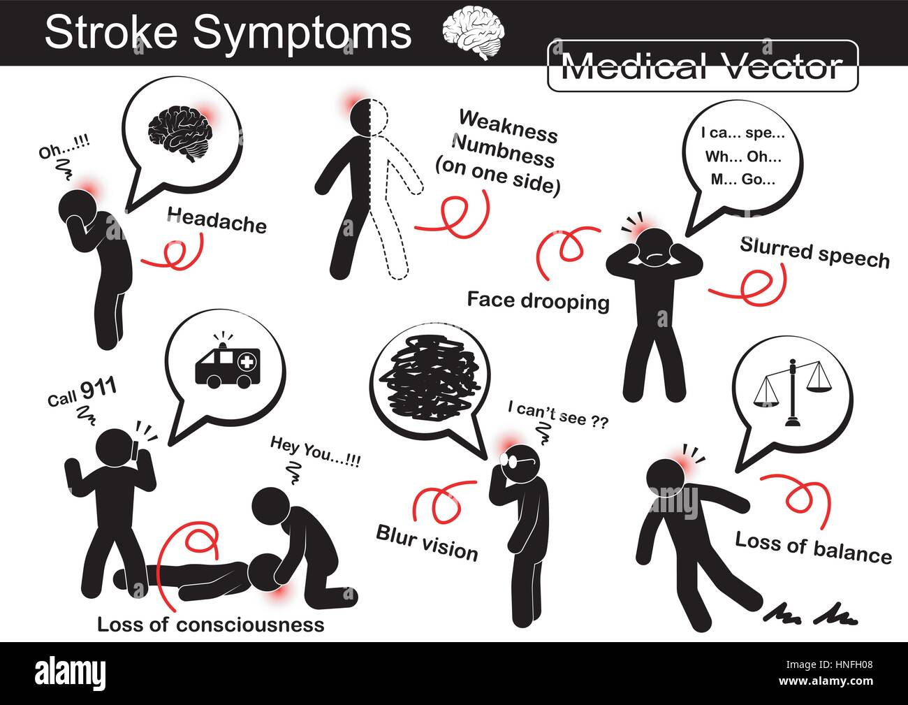 stroke symptoms face