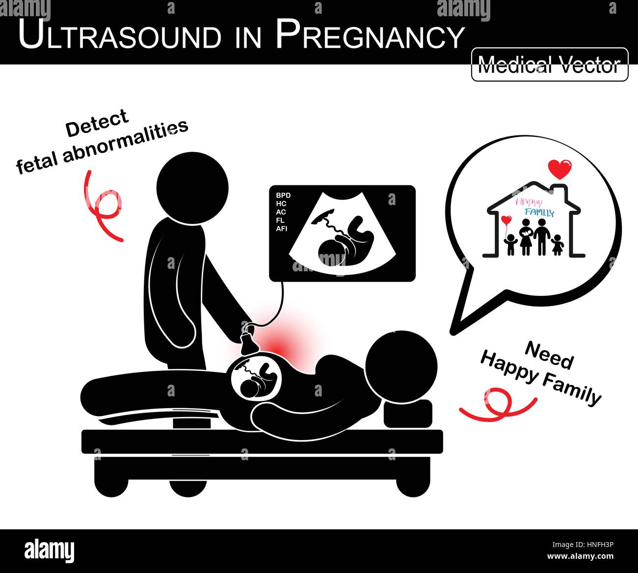Doctor check up pregnant woman and fetal growth in uterus by ultrasonography ( woman think about happy family in future )( Medical , Science and Healt Stock Vector