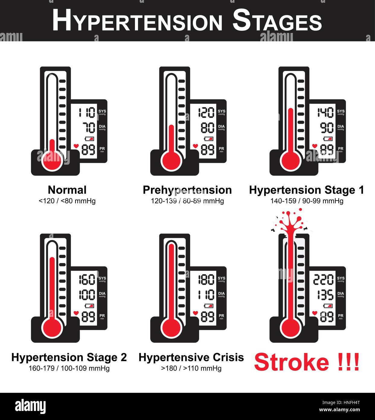 Hypertension stages ( sphygmomanometer and monitor screen show high