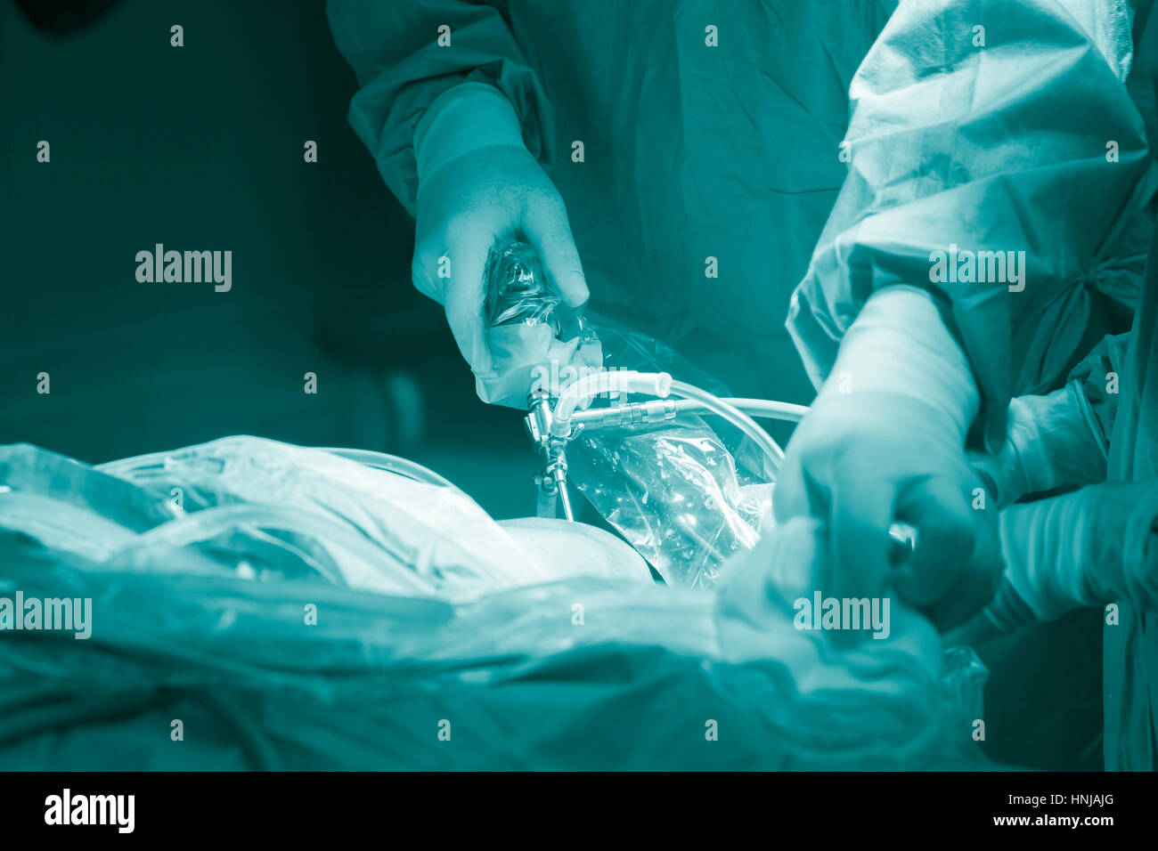 Knee keyhole surgery hospital arthroscopy operation medical procedure