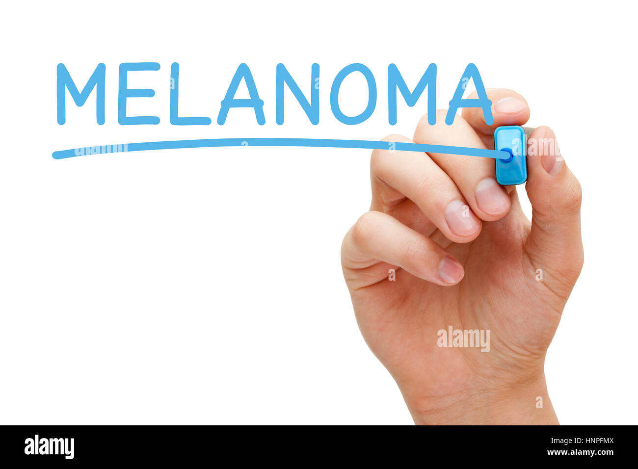 Hand writing Melanoma with blue marker on transparent glass board. Stock Photo