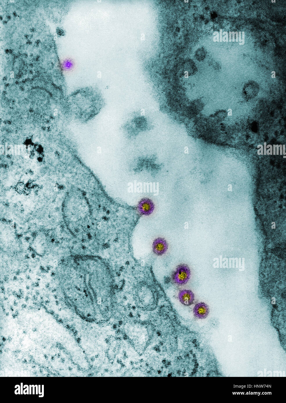 Full frame microscopic image of rubella virus virions budding from the host cell surface to be freed into the host’s system Stock Photo