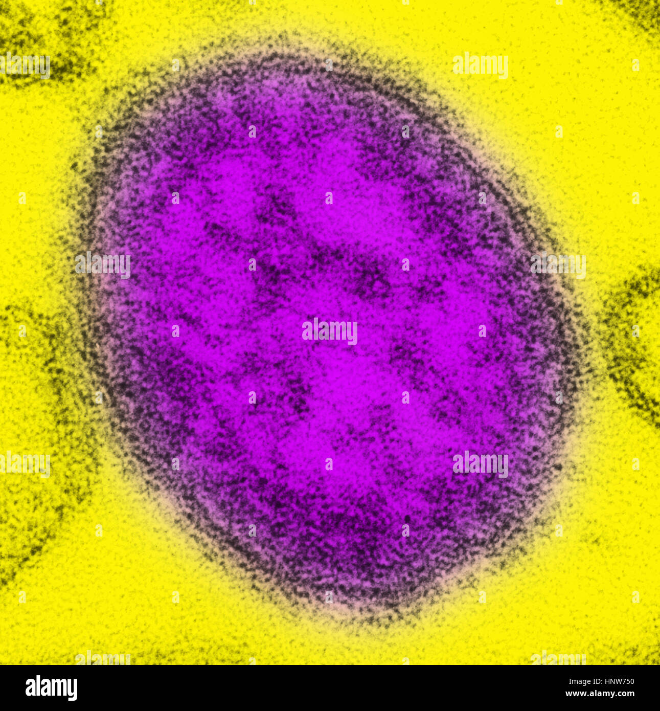 Transmission electron micrograph of a single virus particle, or virion, of measles virus Stock Photo