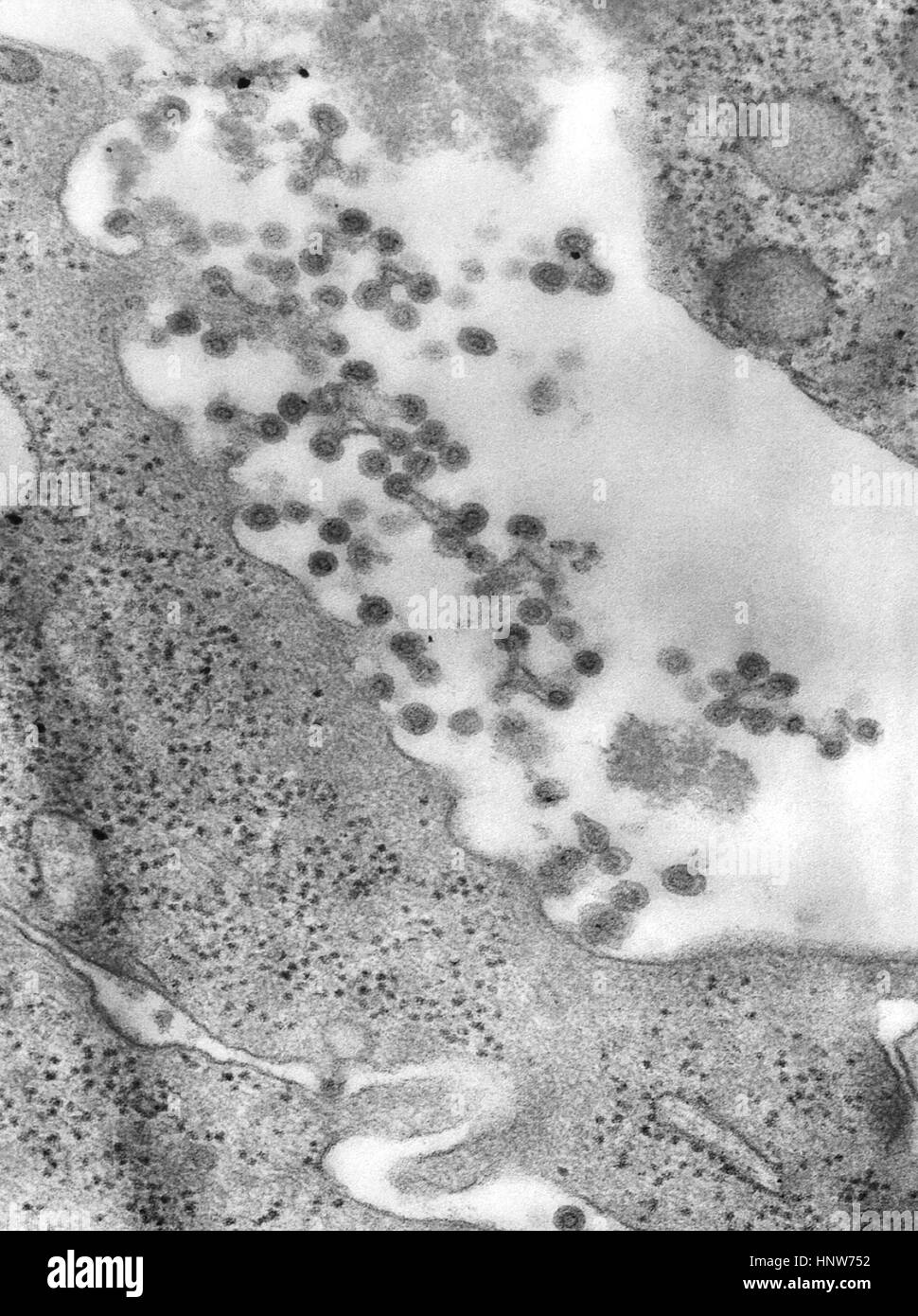 Negatively-stained transmission electron micrograph of Rubella virus virions budding from the host cell surface Stock Photo