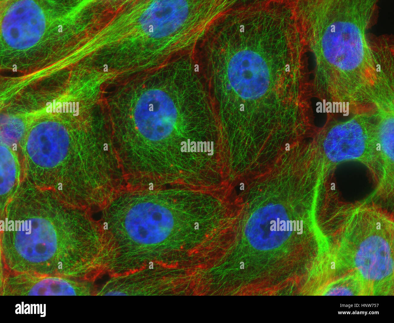 Fluorescence microscopy of stress fibers in breast cancer cells Stock Photo
