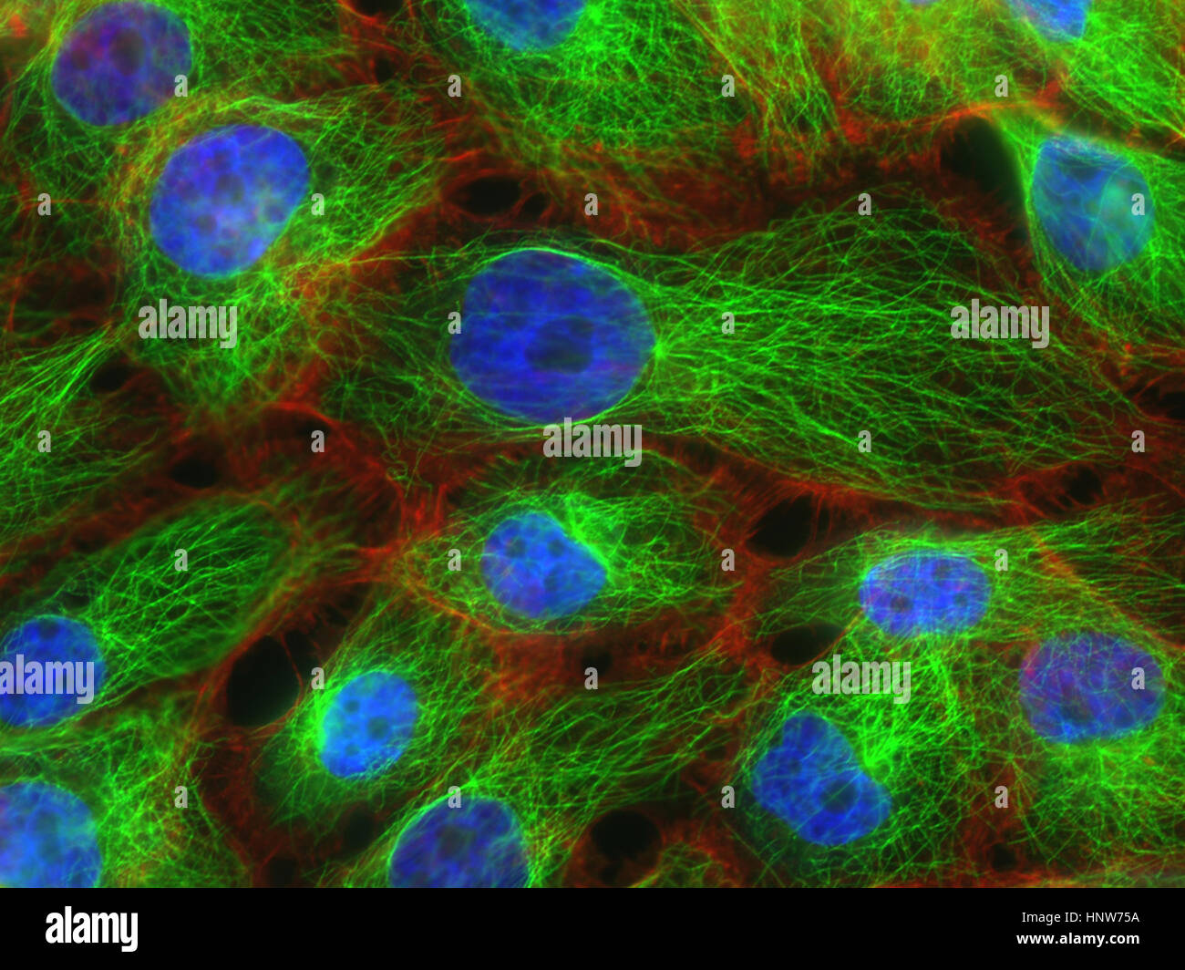 Fluorescence microscopy of stress fibers in breast cancer cells Stock Photo
