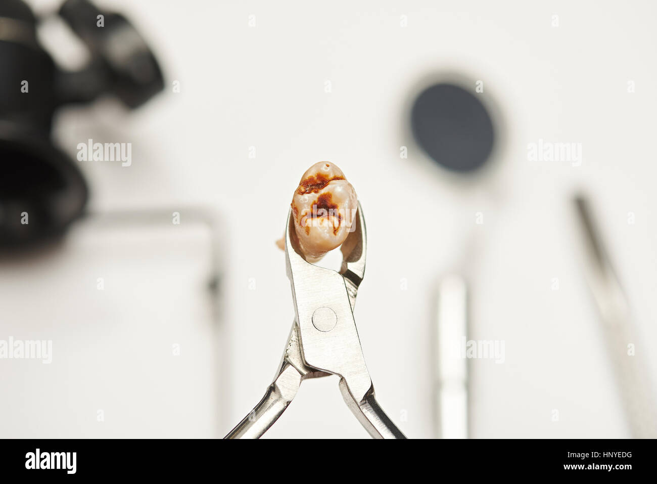 Yellow damaged cavity teeth close up on dental tools background Stock