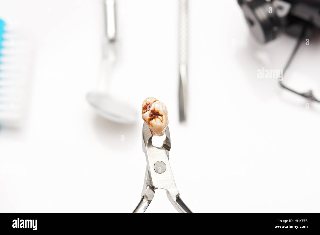 Macro of teeth with cavity extracted isolated on dental background Stock Photo
