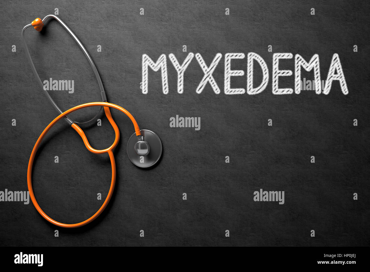 Myxedema - Text on Chalkboard. 3D Illustration. Stock Photo