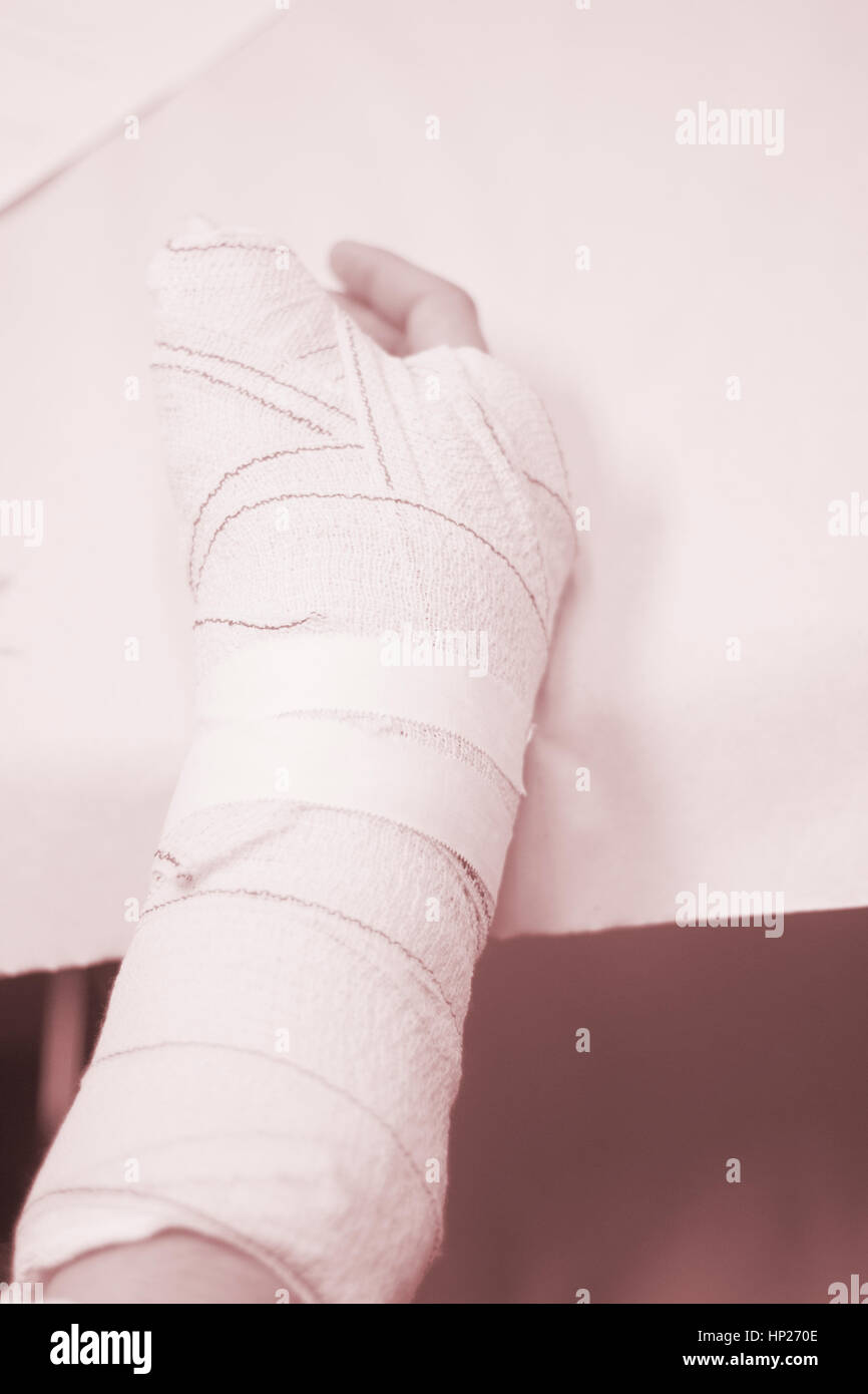 plaster bandage hand casting plaster bandage hand casting