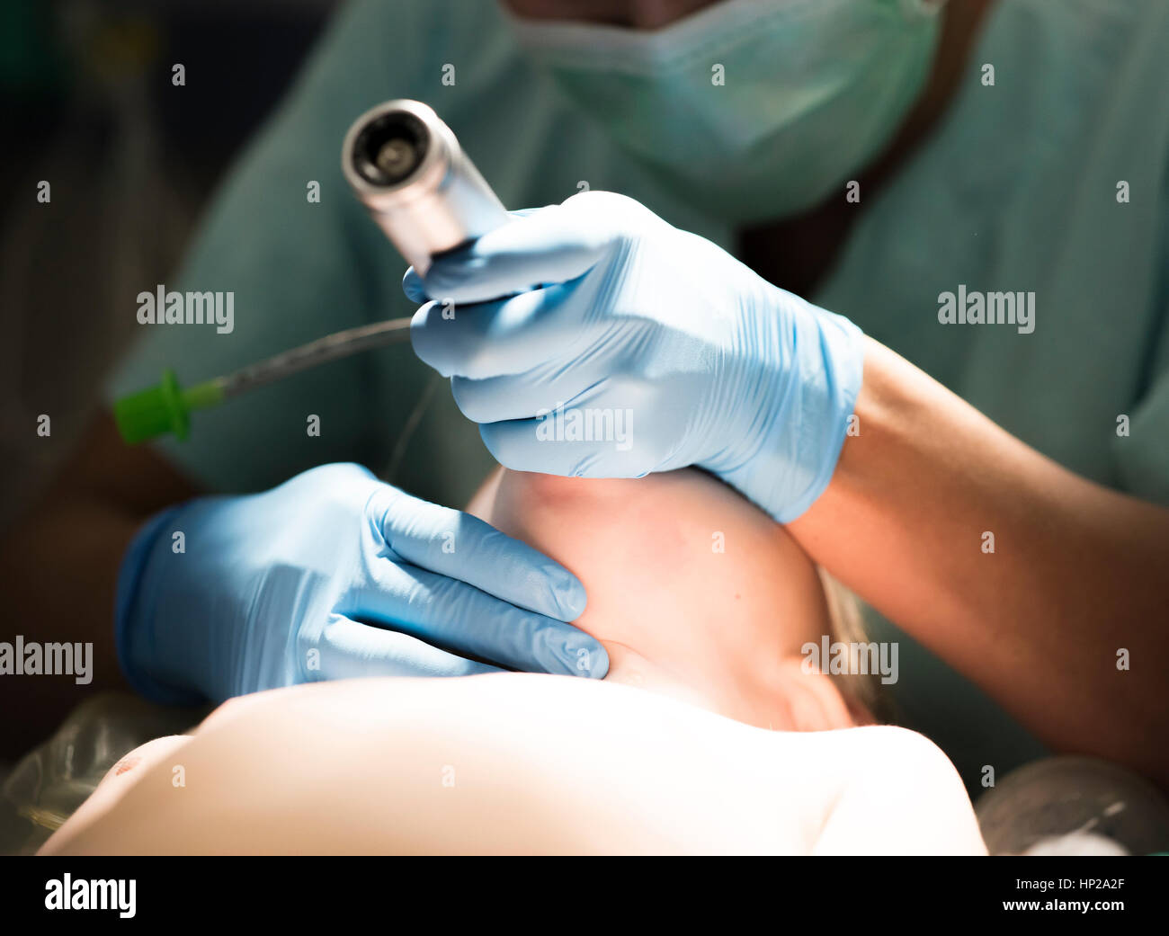 anesthesiologist performs nasotracheal intubation patient Stock Photo