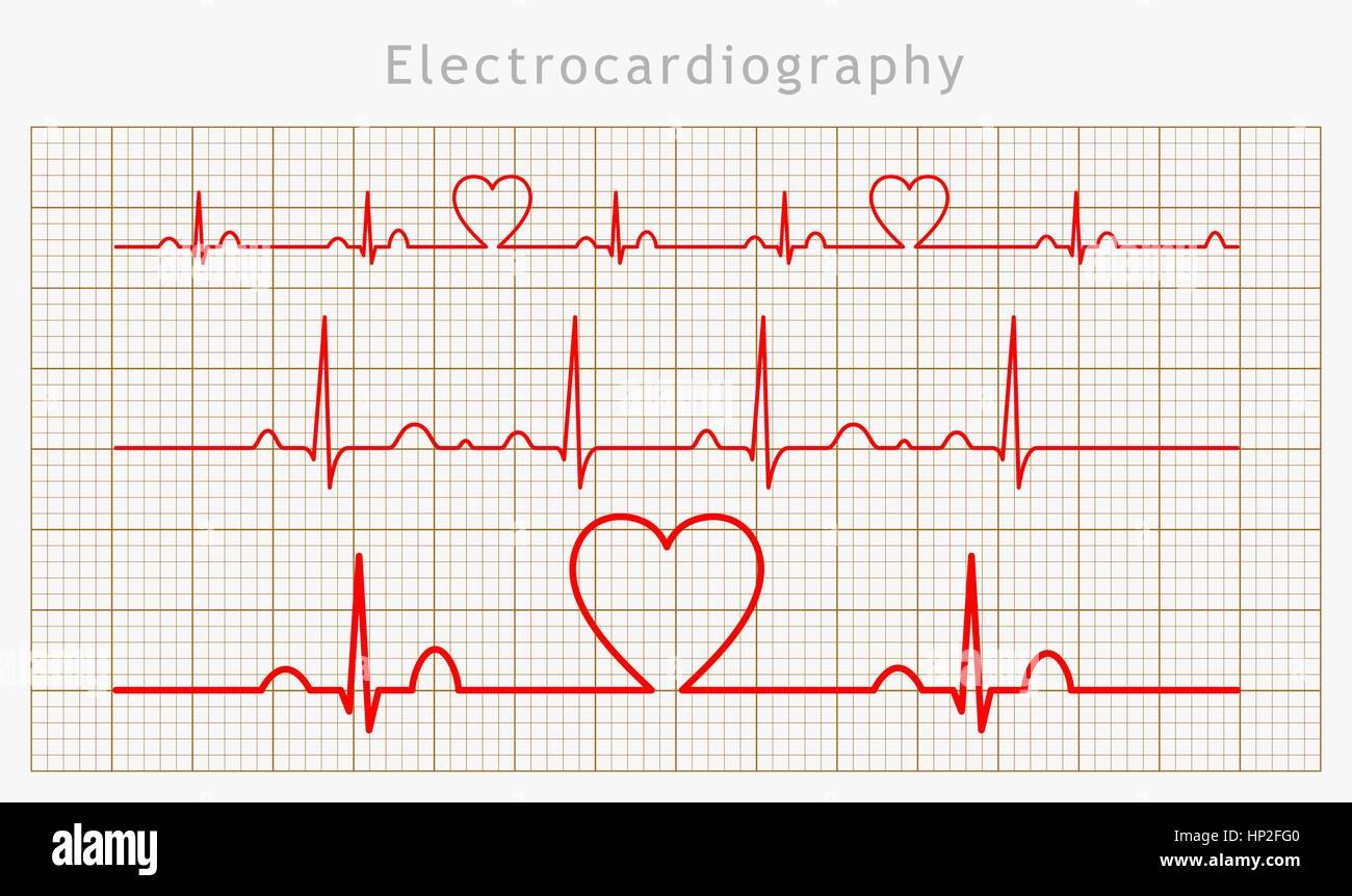Vector Heart cardiogram charts set Stock Vector