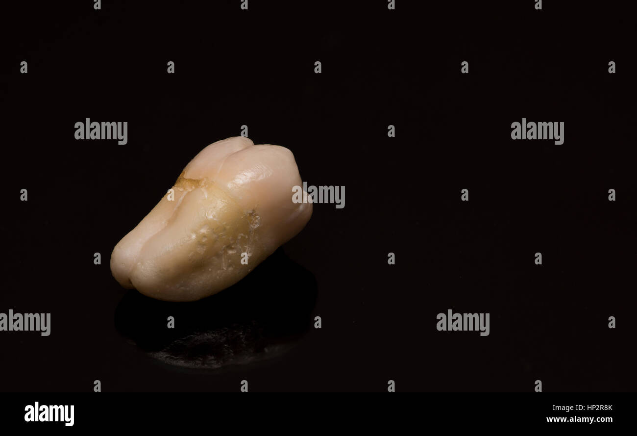 close-up of human tooth on a black background Stock Photo - Alamy