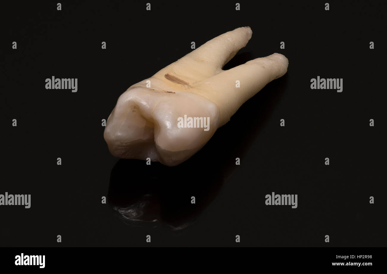 close-up of human tooth on a black background Stock Photo - Alamy