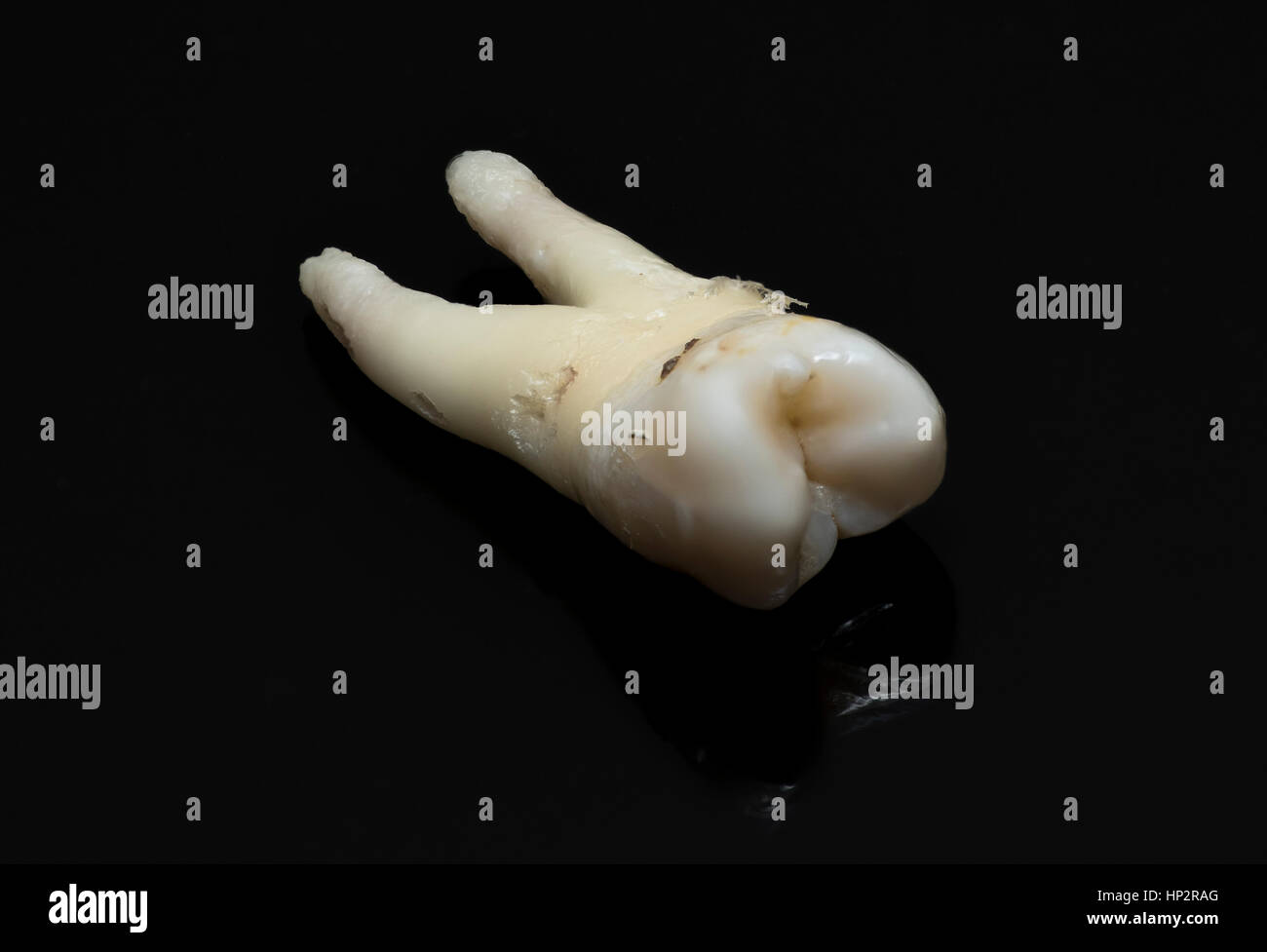 close-up of human tooth on a black background Stock Photo - Alamy