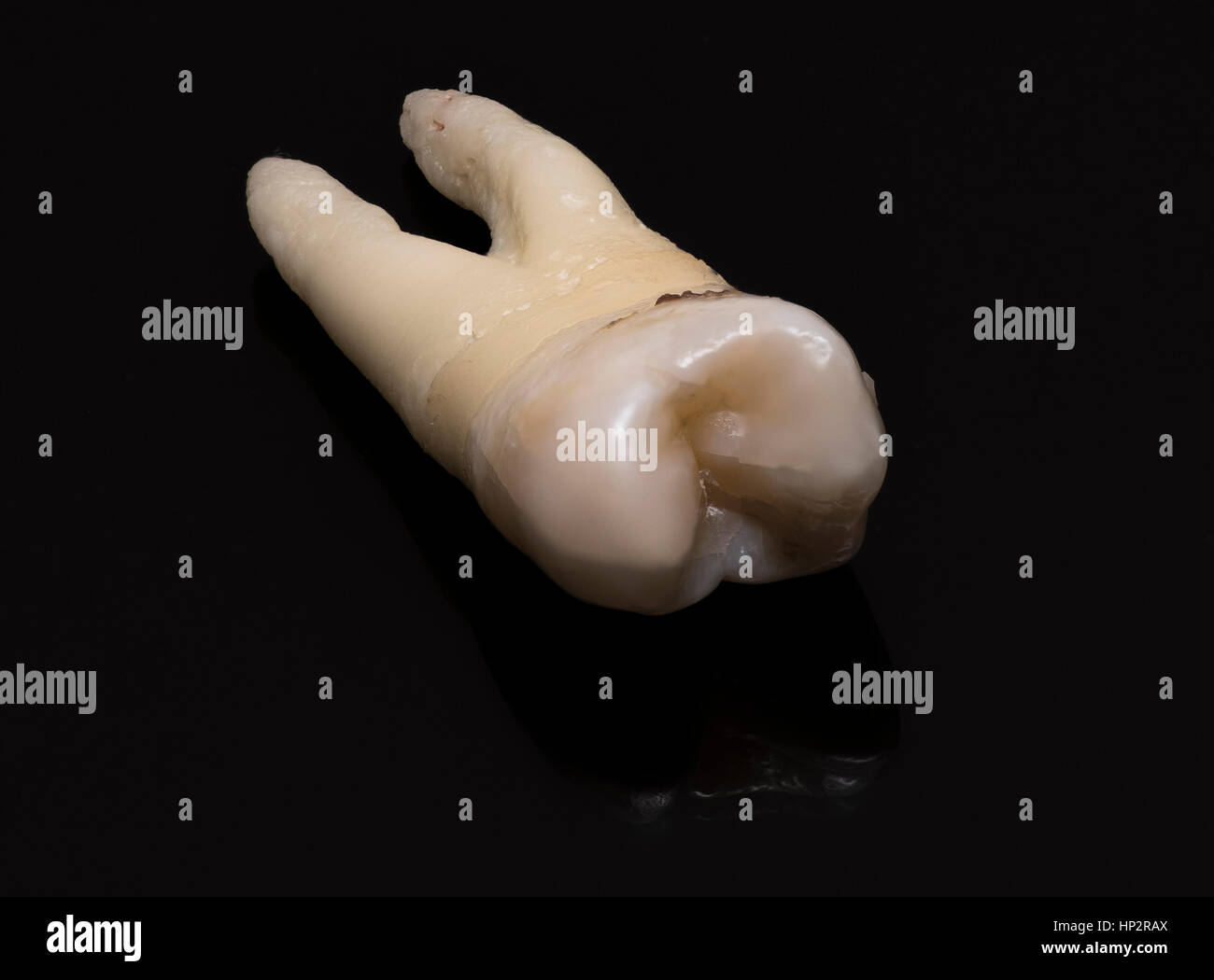 close-up of human tooth on a black background Stock Photo - Alamy