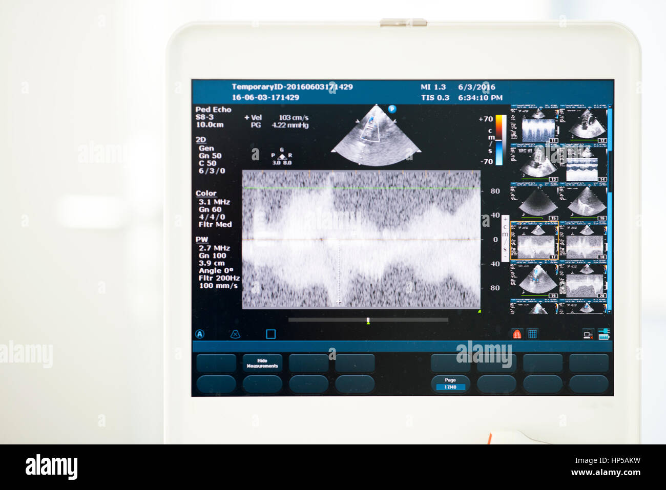 ultrasound scanner screen Stock Photo - Alamy