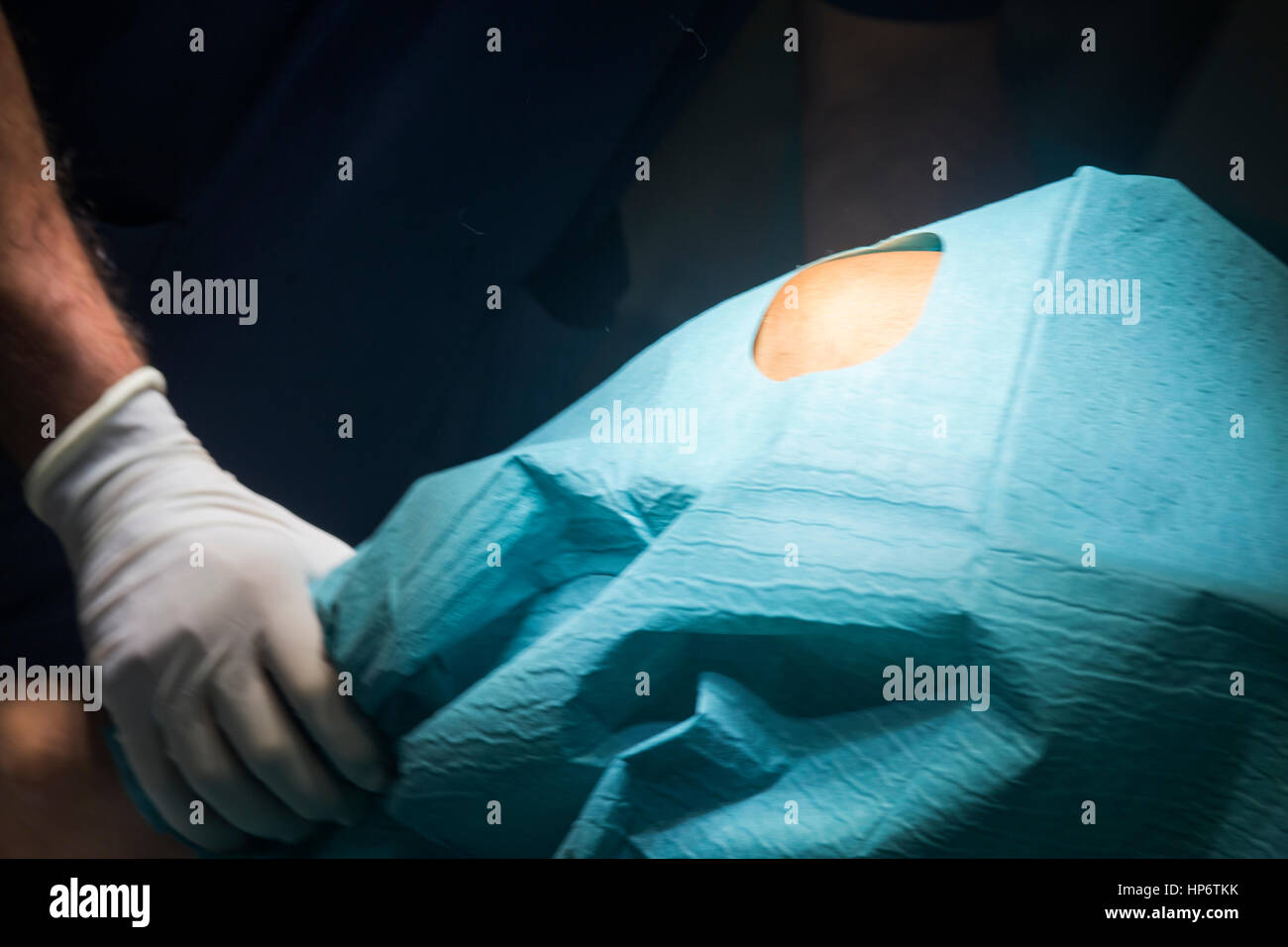 Preparing knee for surgery hospital operation medical procedure in emergency room operating theater. Stock Photo