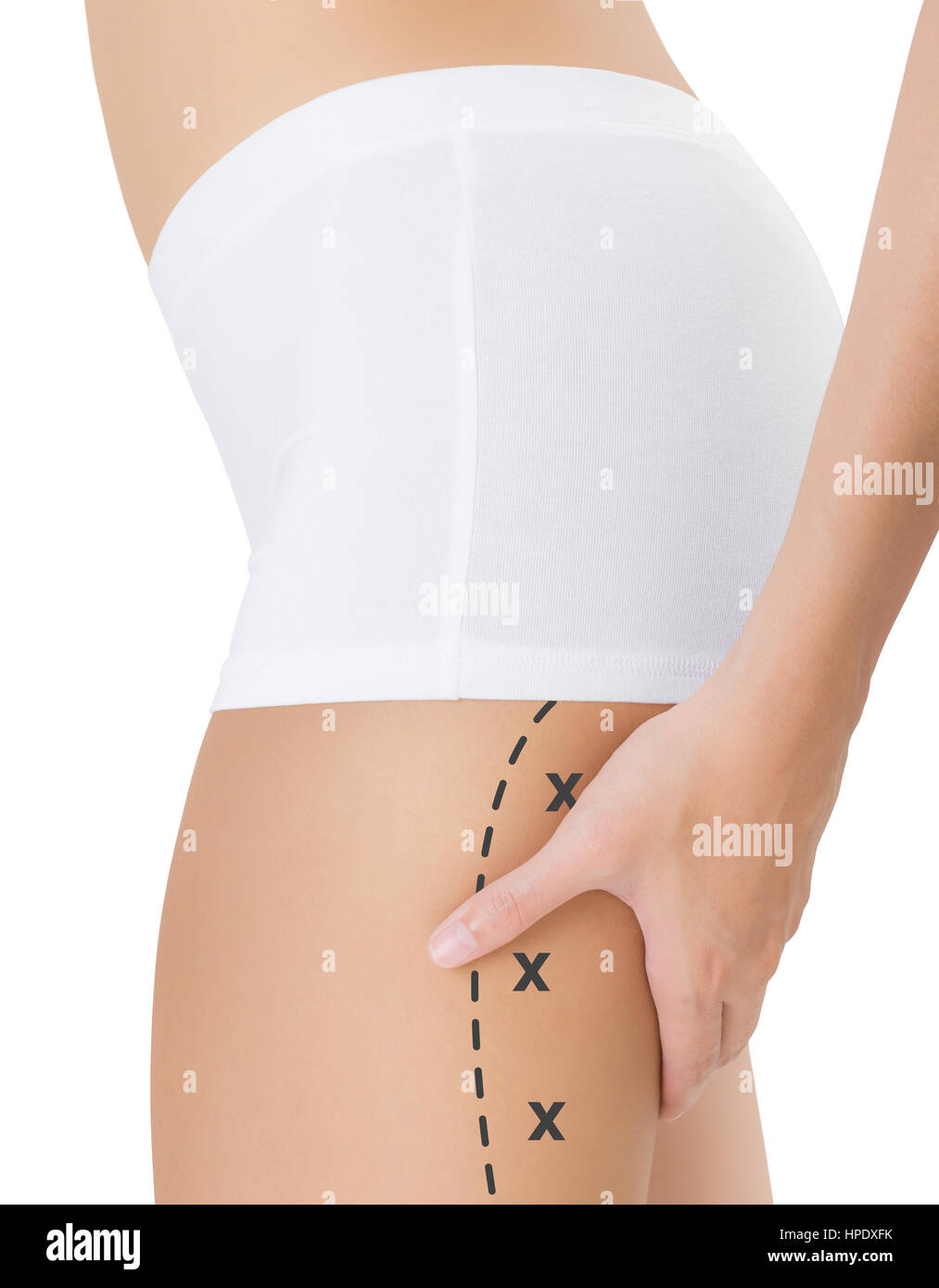 Woman squeezing rear thigh with the black color crosses marking, Lose weight and liposuction cellulite removal concept, Isolated on white background. Stock Photo