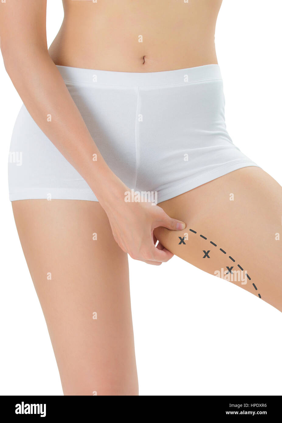 Woman grabbing skin on her Inner thigh with the black color crosses marking, Lose weight and liposuction cellulite removal concept, Isolated on white  Stock Photo