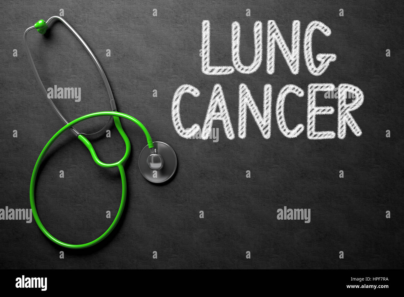 Medical Concept: Lung Cancer - Medical Concept on Black Chalkboard. Medical Concept: Black Chalkboard with Lung Cancer. 3D Rendering. Stock Photo