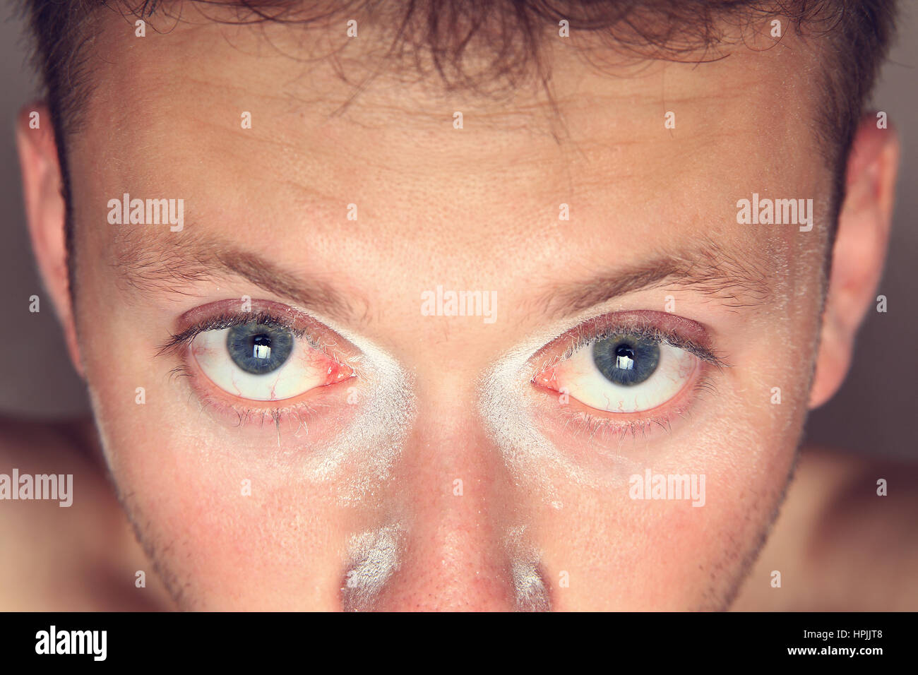 Whitewash in irritation eyes and on face skin Stock Photo