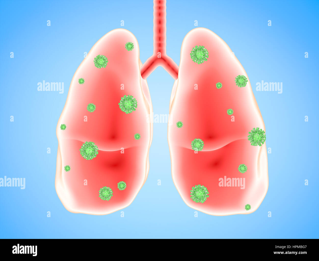 3d rendering lung disease with bacteria cells Stock Photo Alamy