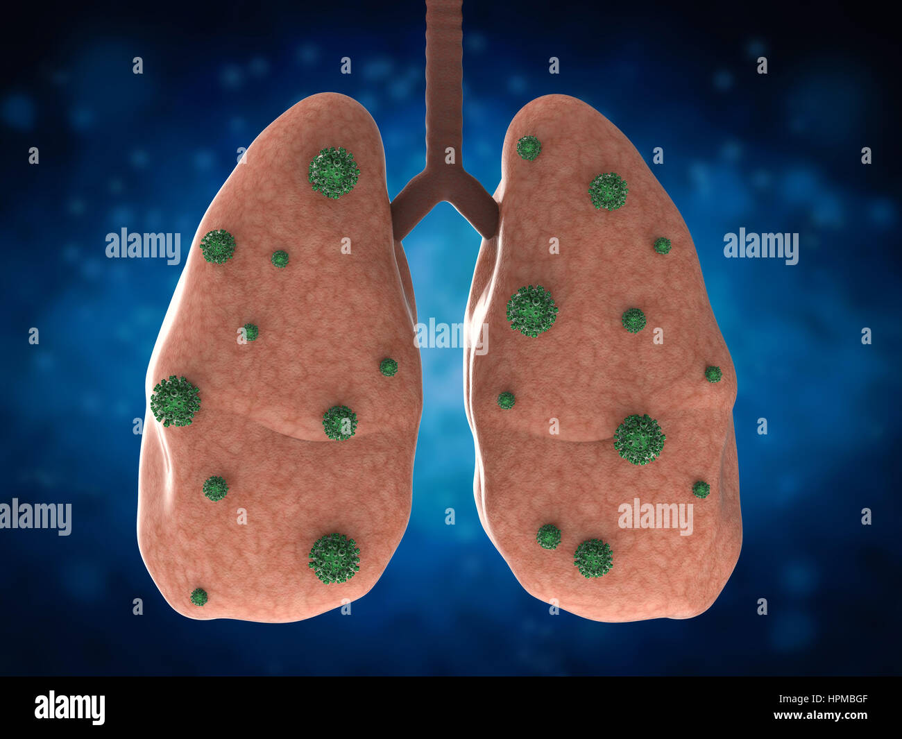 3d rendering lung disease with bacteria cells Stock Photo Alamy