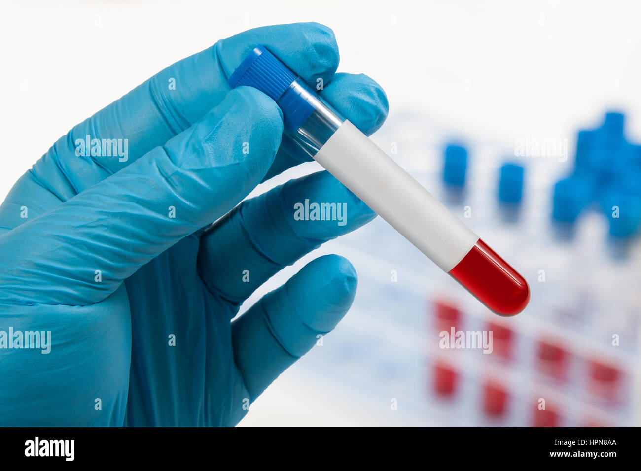 Blood sample with blank label. Empty space for text Stock Photo