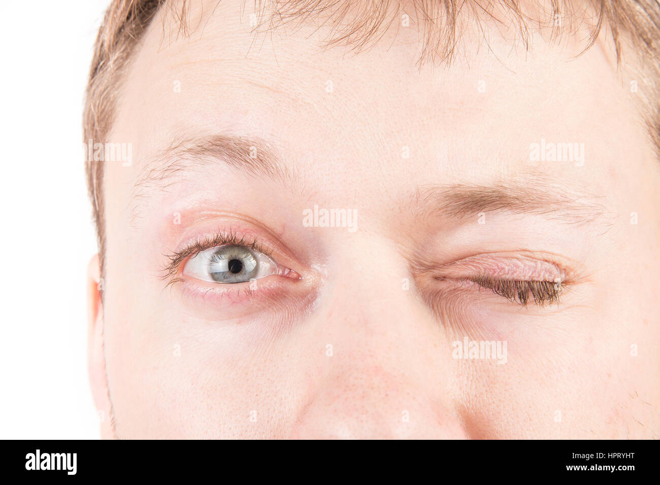 Man's tired gray eyes with clean skin Stock Photo