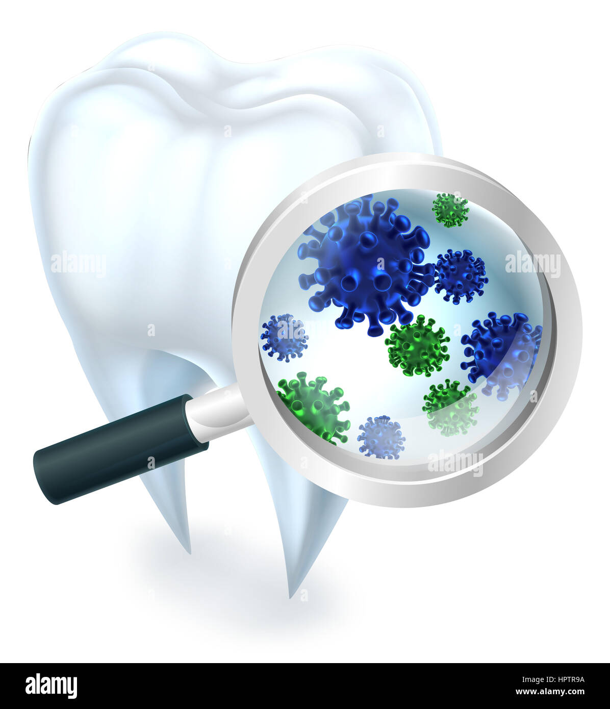 A medical dental illustration of a tooth covered in bacteria viewed through a magnifying glass Stock Photo